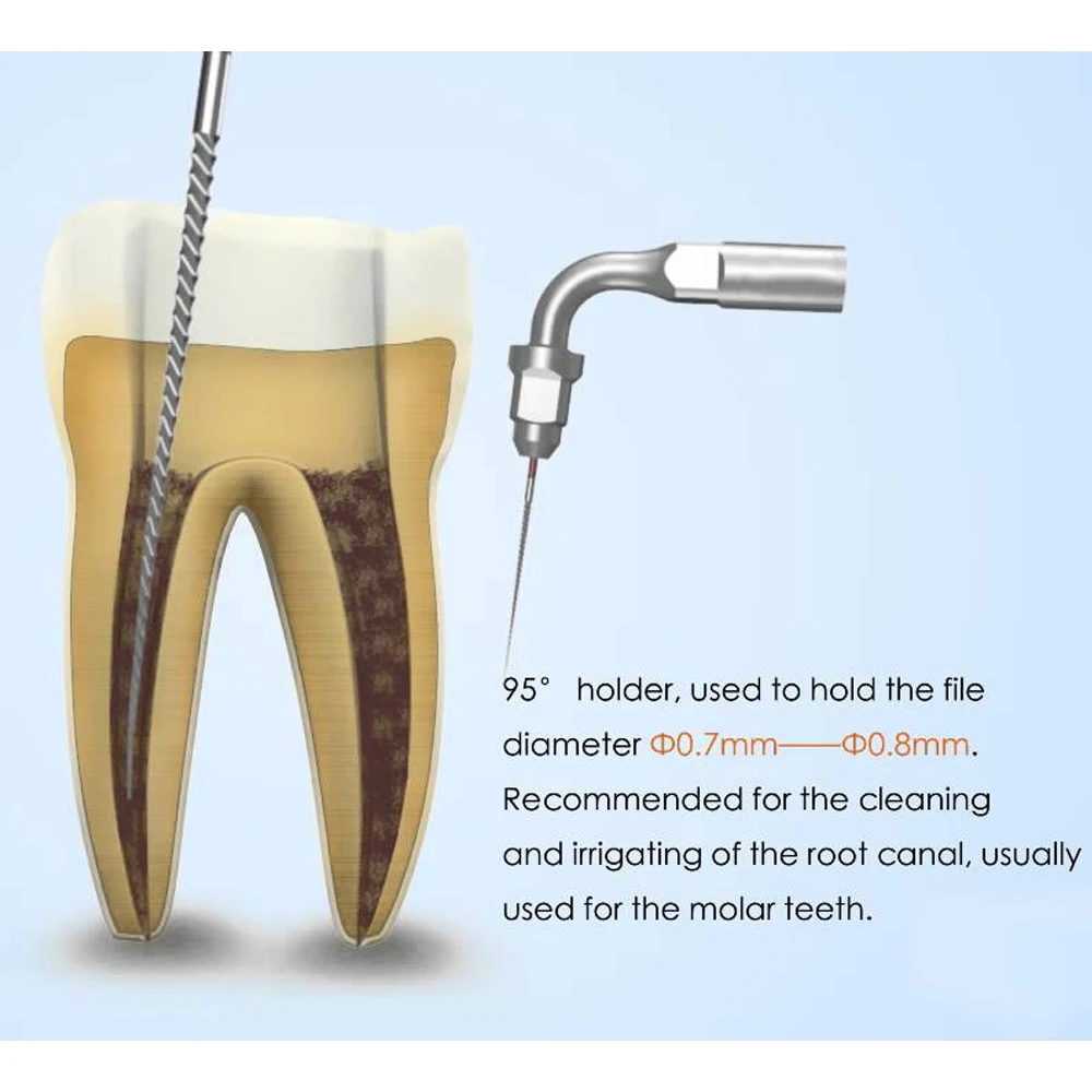 Woodpecker Endodontic Scaler Tips for DTE & Satelec Scalers