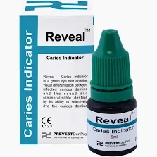 Prevest Reveal